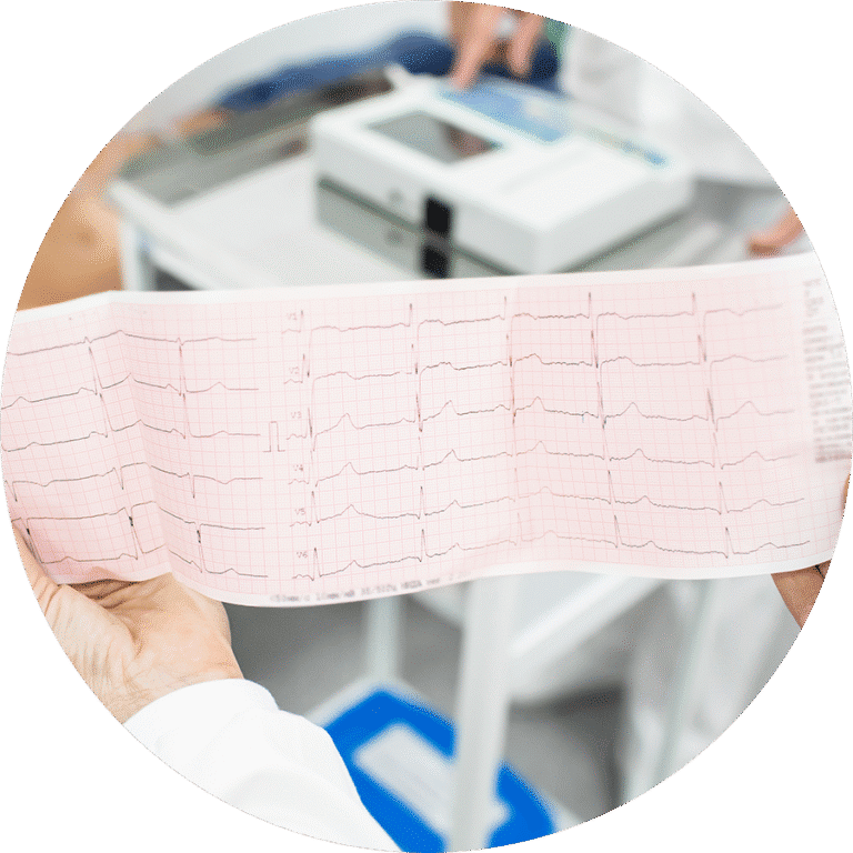 ECG Eletrocardiograma para colaboradores